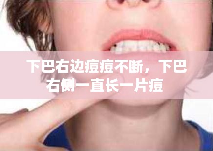 下巴右边痘痘不断，下巴右侧一直长一片痘 