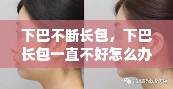 下巴不断长包，下巴长包一直不好怎么办 